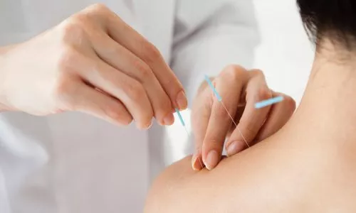 acupuncture Formation Certifiante en Acupuncture