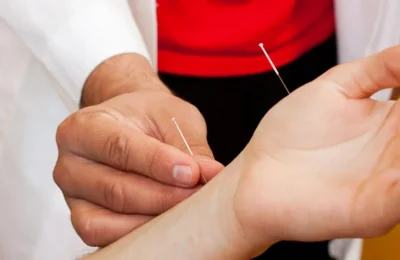 Formation en Acupuncture du poignet et de la cheville